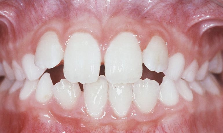 Habit-020130-PostFrontal-web