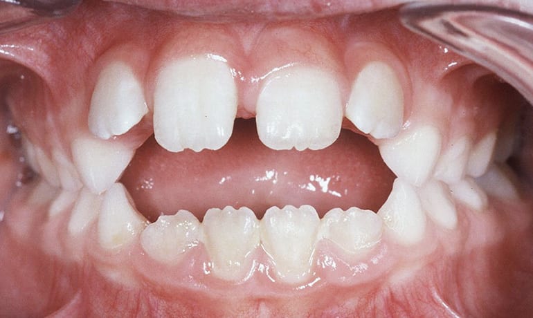 Habit-020130-PreFrontal-web